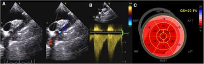 The mechanics of congenital heart disease: from a morphological trait to the functional echocardiographic evaluation
